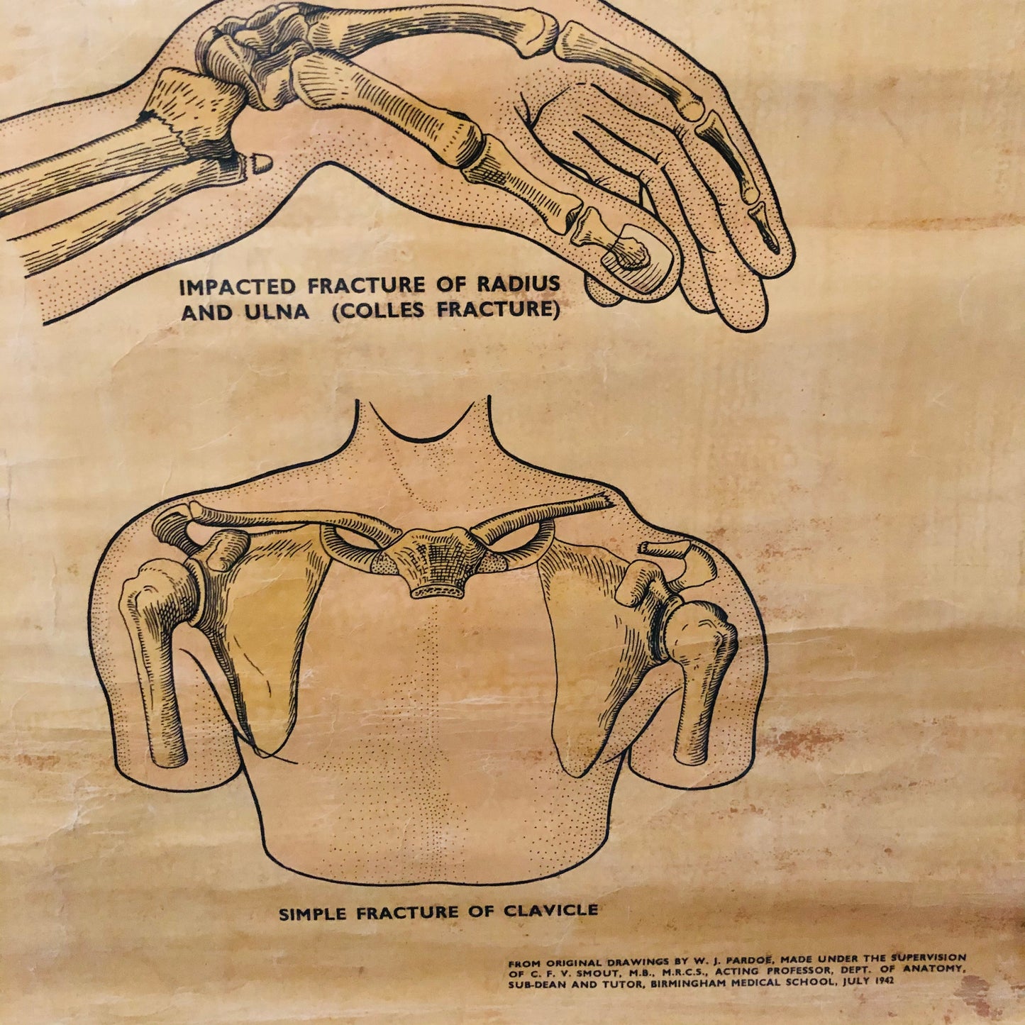 Vintage Anatomy Medical First Aid Poster Adam Rouilly