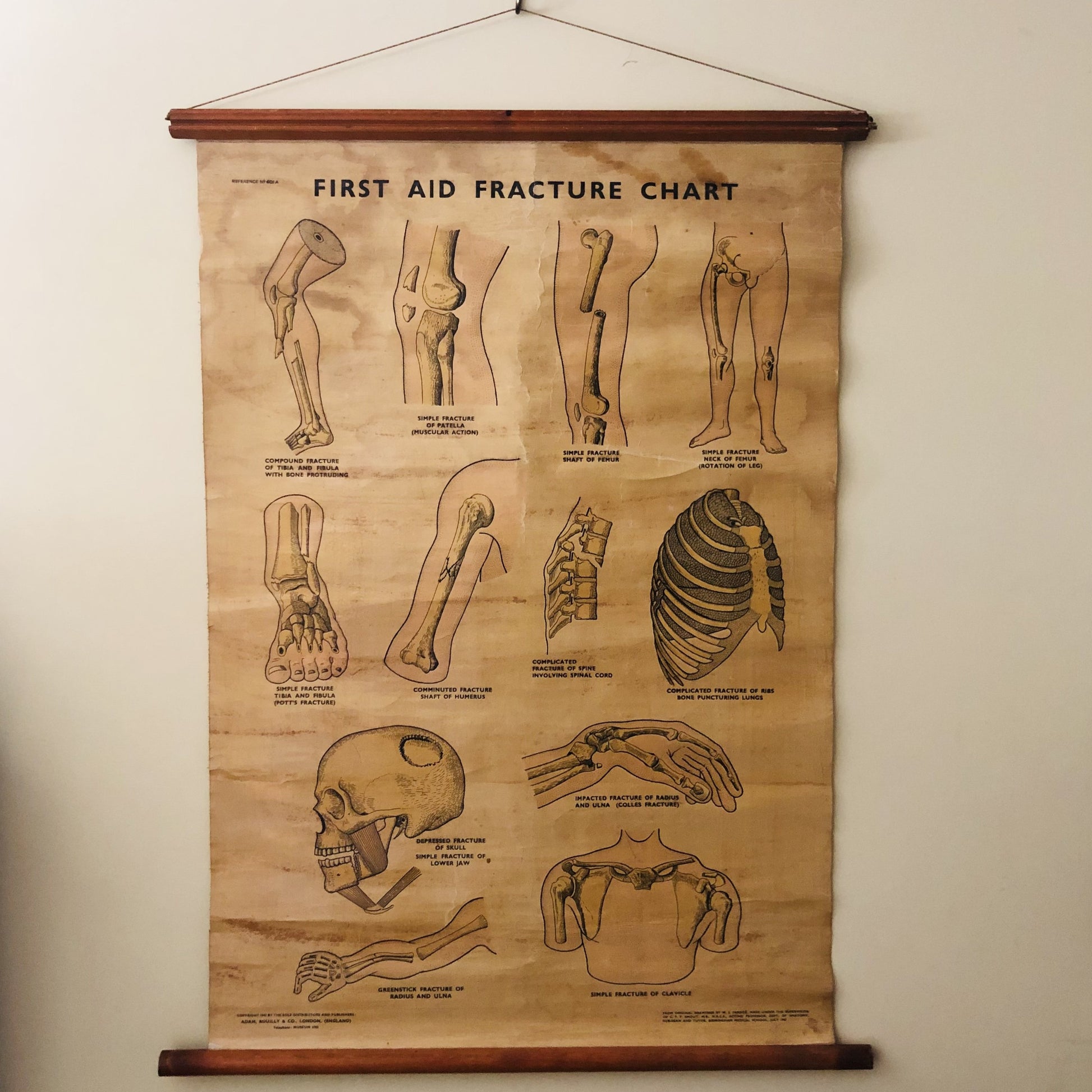 Vintage Anatomy Medical First Aid Poster Adam Rouilly