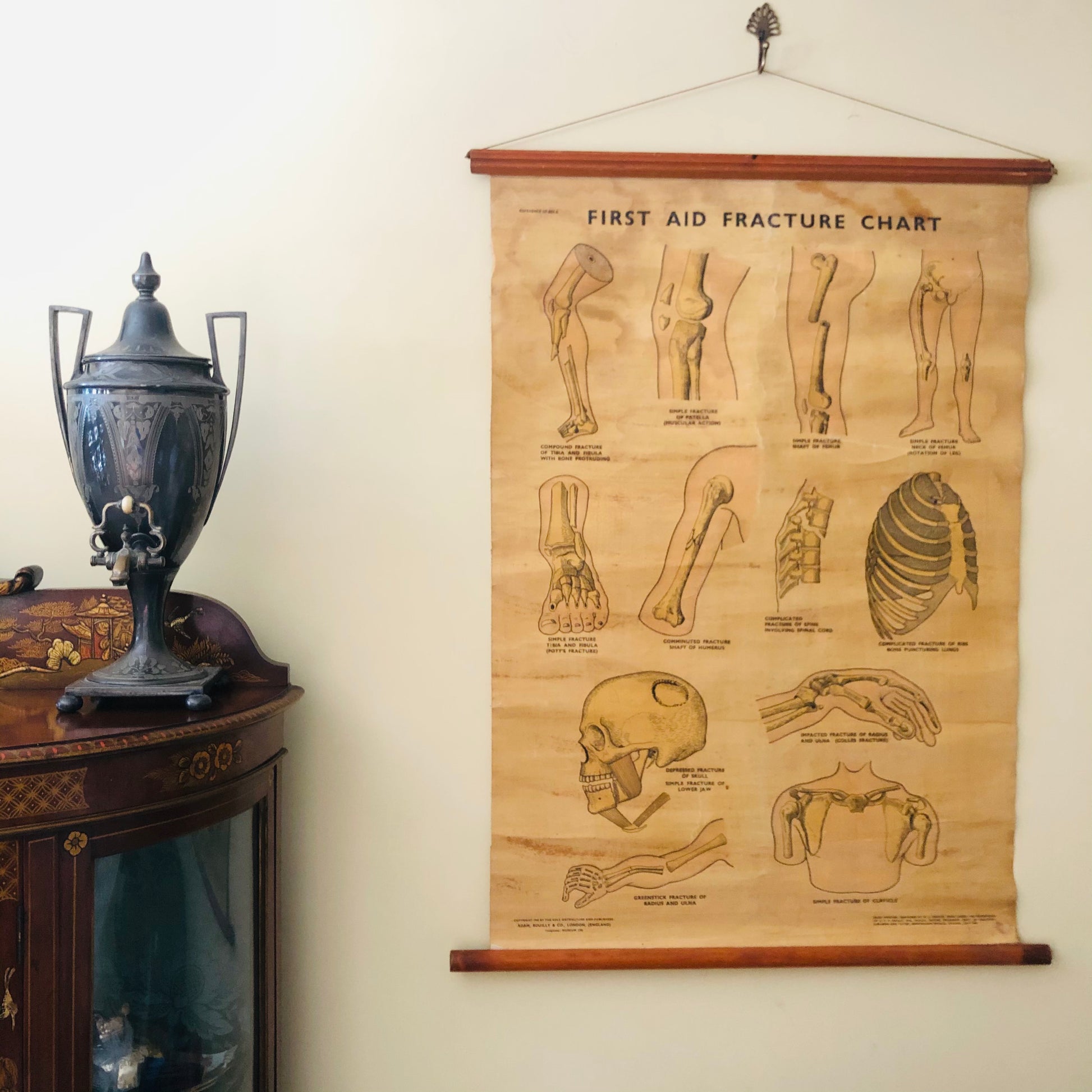 Vintage Anatomy Medical First Aid Poster Adam Rouilly