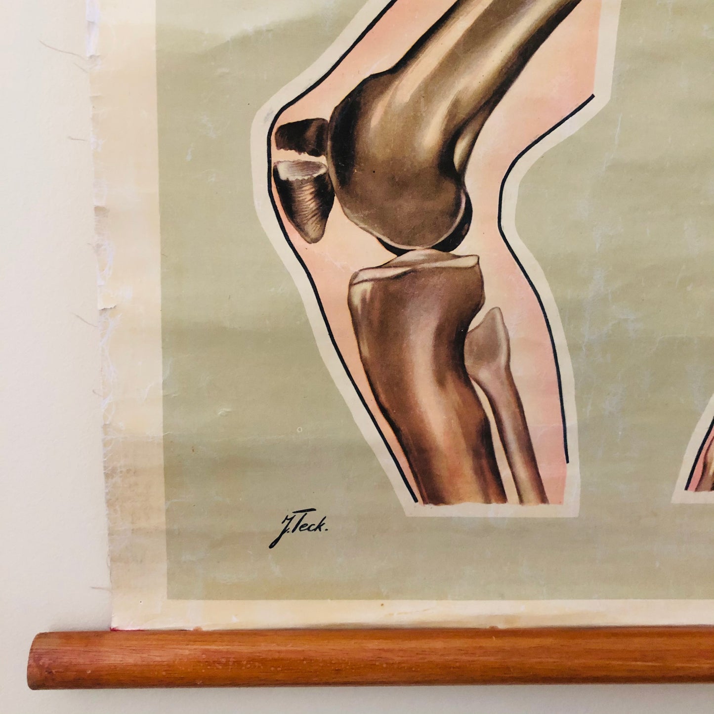 Vintage Fracture Poster St John Ambulance Anatomical By J Teck