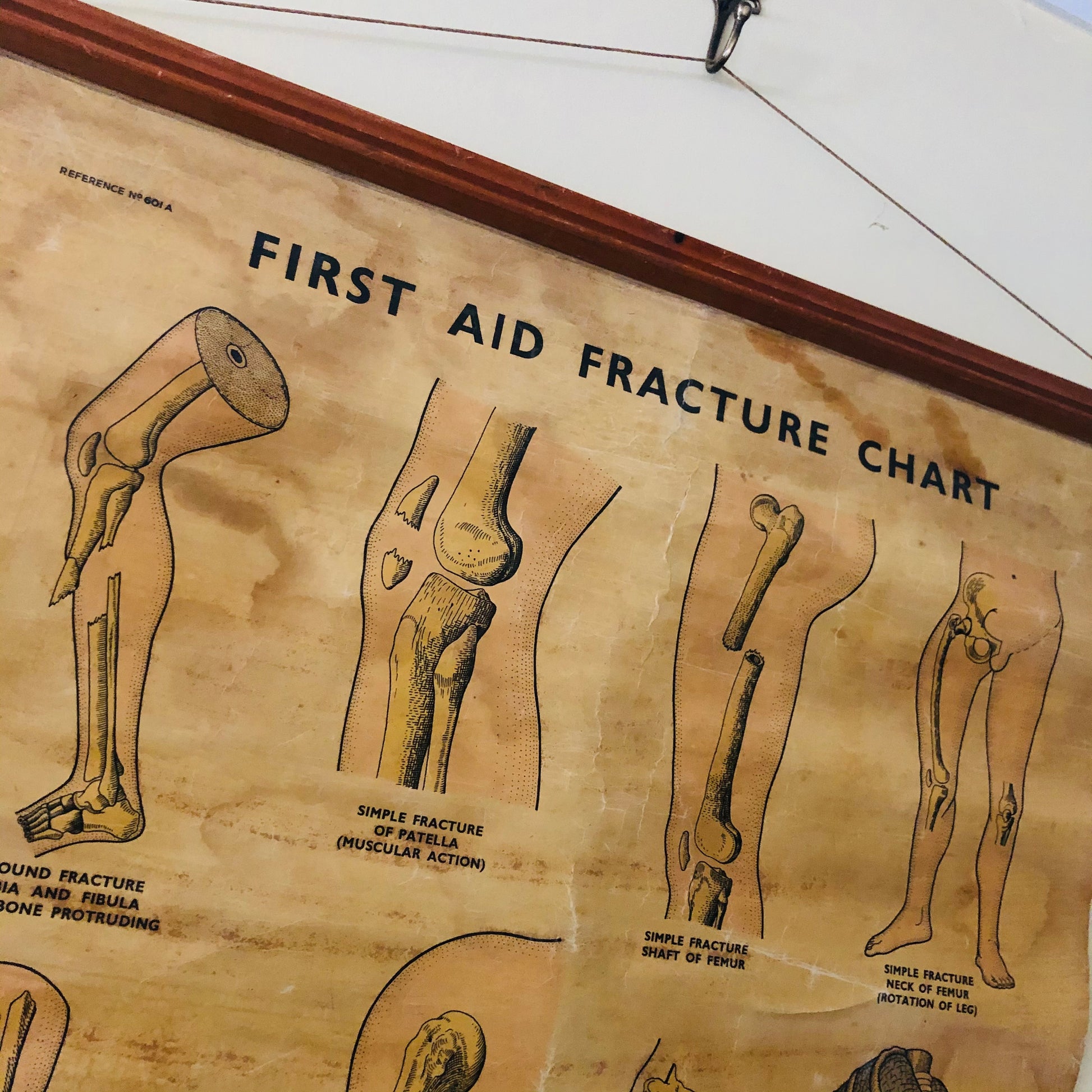 Vintage Anatomy Medical First Aid Poster Adam Rouilly