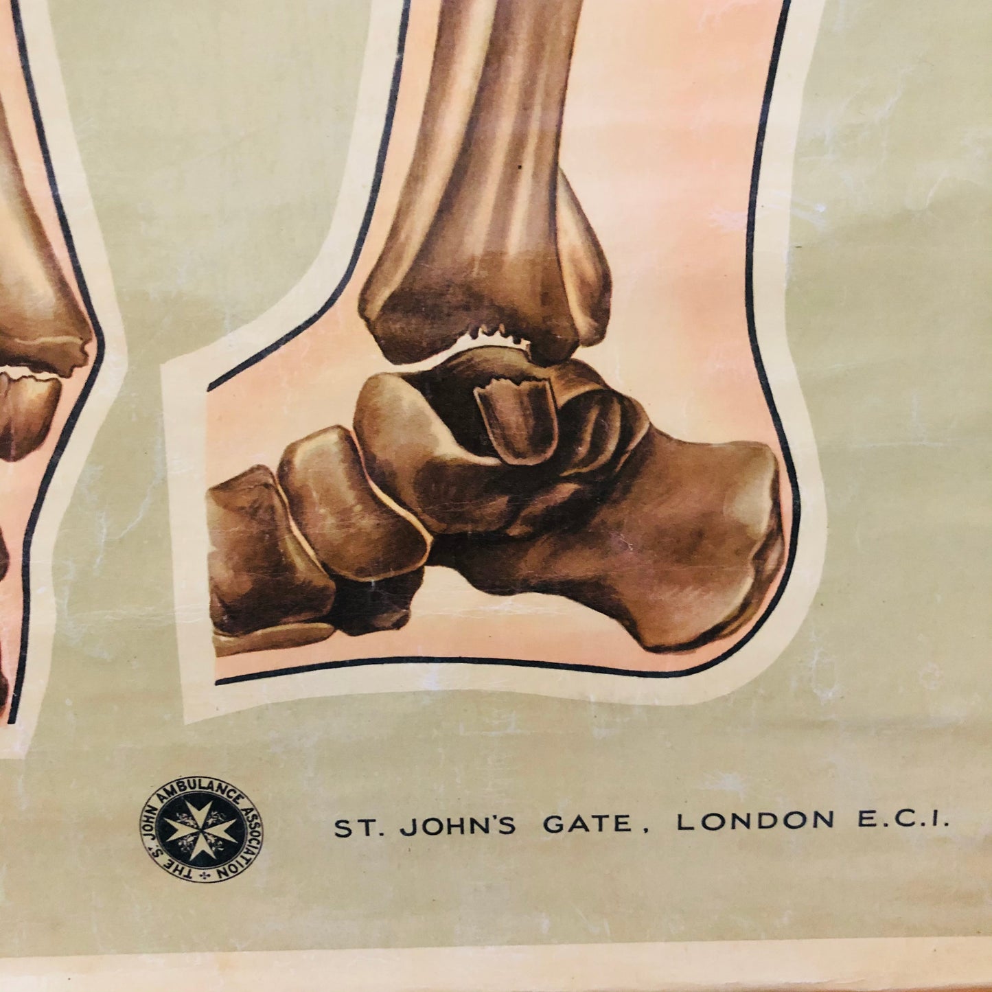 Vintage Fracture Poster St John Ambulance Anatomical By J Teck